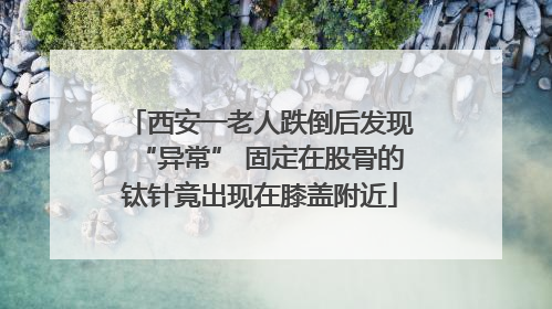西安一老人跌倒后发现“异常” 固定在股骨的钛针竟出现在膝盖附近